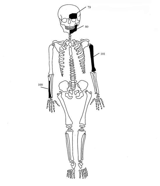 skeletos1